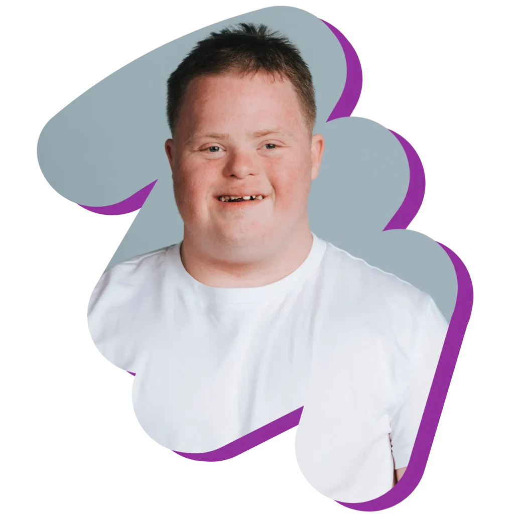 Disabled boy smiling at camera